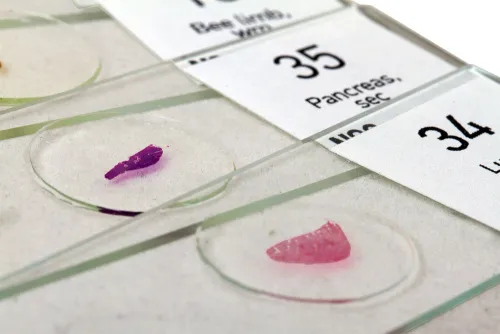 resim Levenhuk N80 NG “Her şeyi görün” Slayt Seti,  6