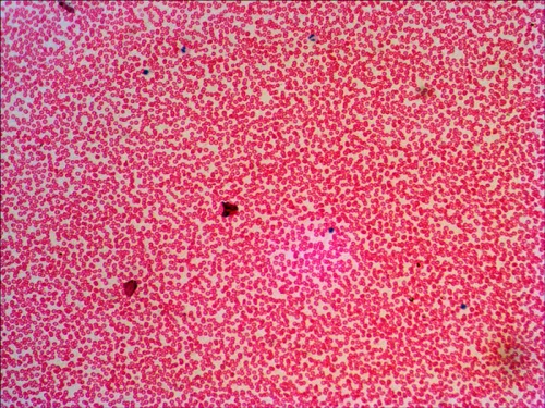 görüntü Levenhuk N38 NG Hazırlanmış Slayt Seti,  16